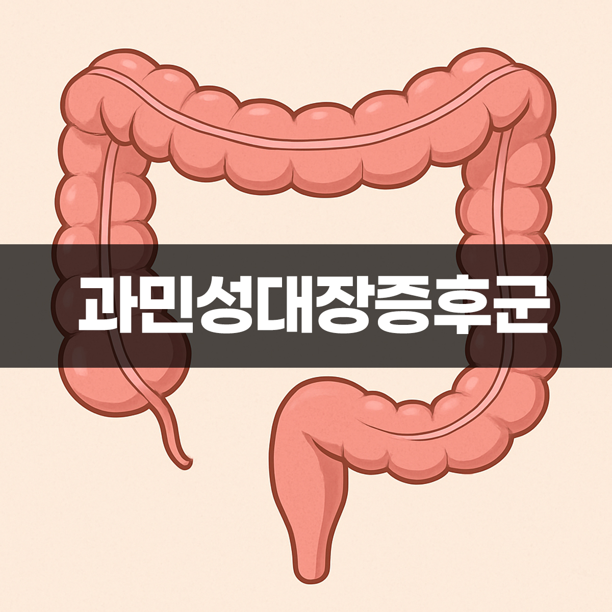 과민성대장증후군 증상을 설명하기 위한 대장 구조 일러스트 이미지